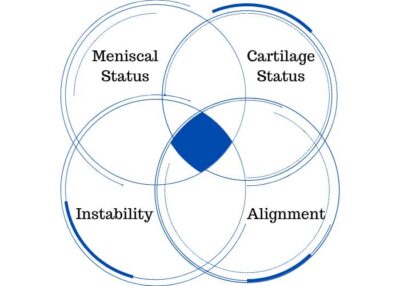 Malalignment | Knock-Knee | Bow Legged | Orthopedic Knee Specialist ...