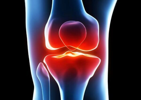 Knee Cartilage | Vail CO