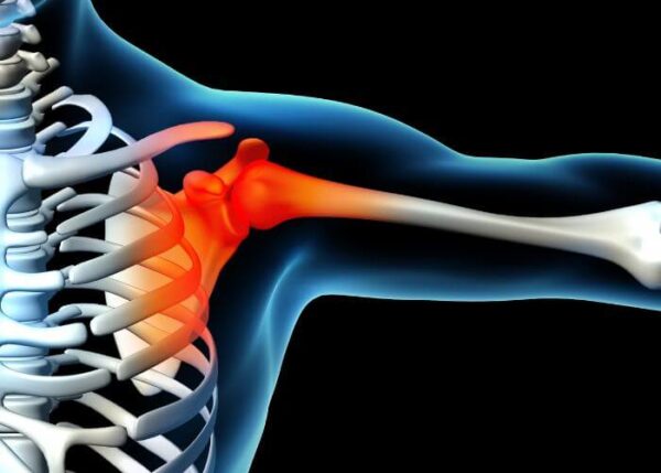 Shoulder Disorders | Vail CO